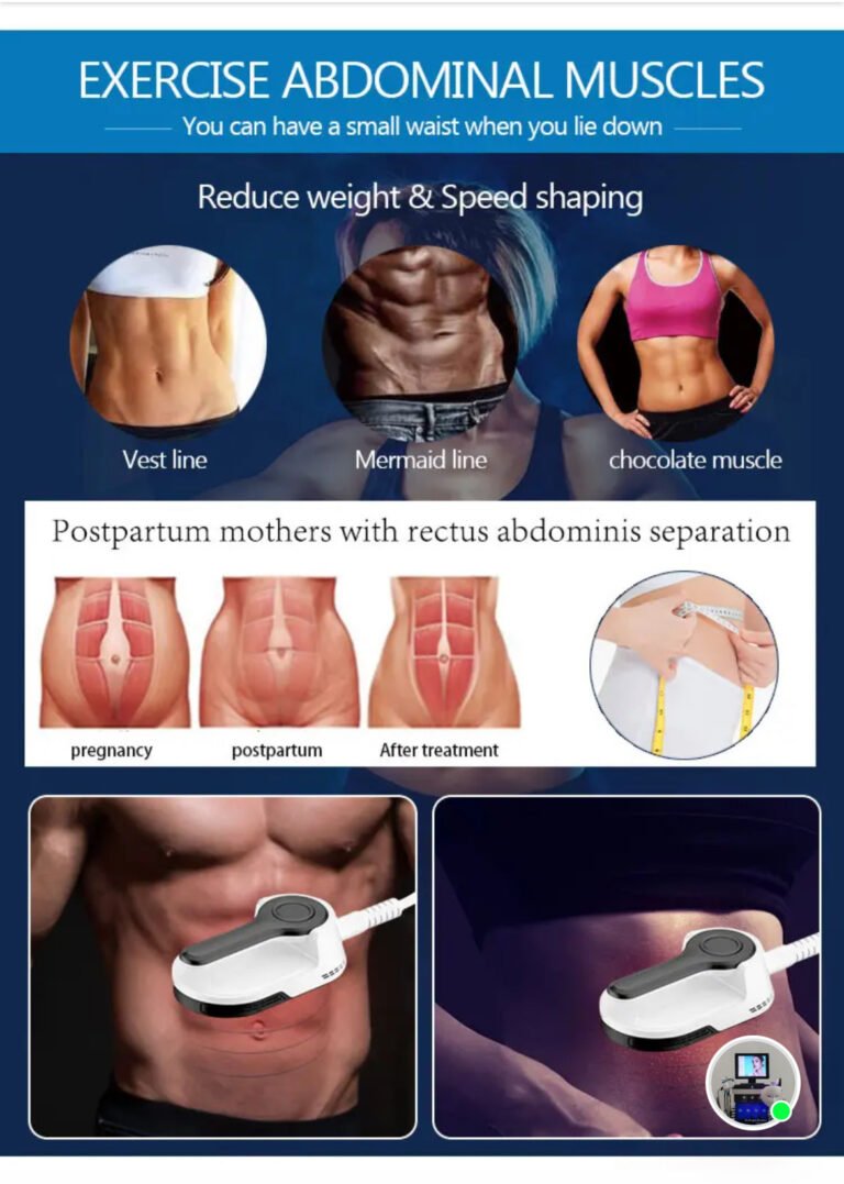 EMSculpt