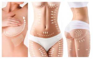 Postoperative lymphatic drainage